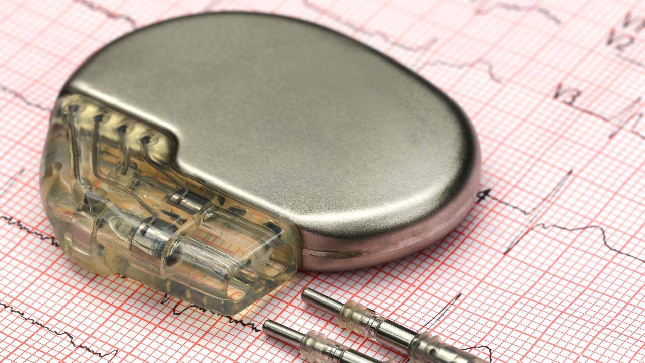 hermetically sealed pacemaker